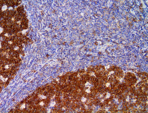 IHC of hGAL on an FFPE Tonsil Tissue